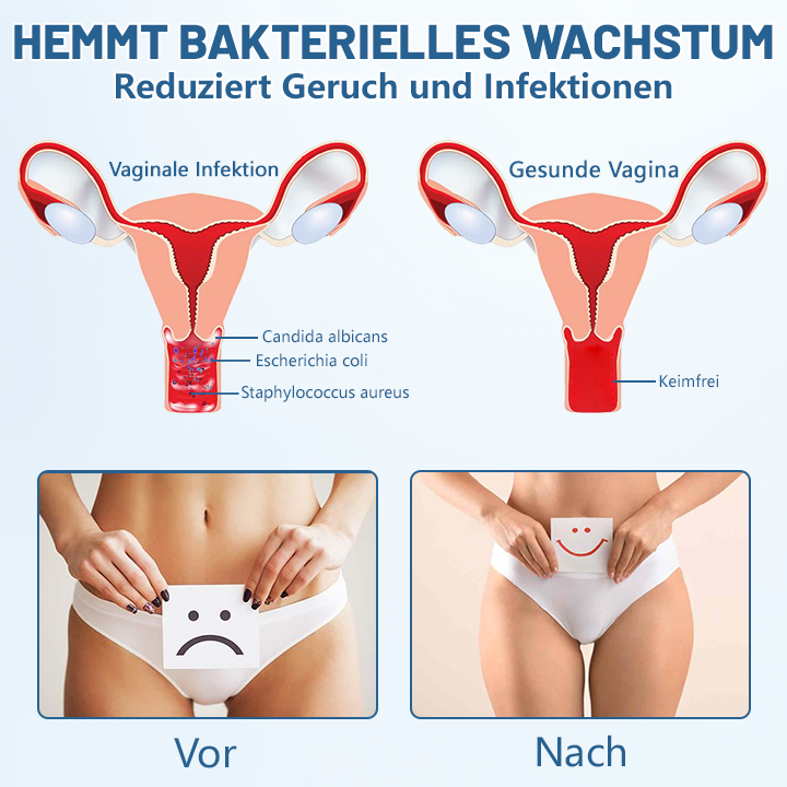Ceoerty™ FreshShape antibakteriális formázó fehérnemű