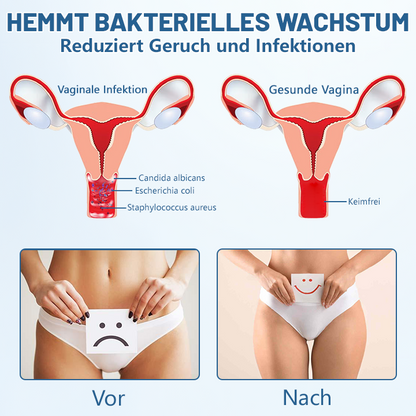 Ceoerty™ FreshShape antibakteriális formázó fehérnemű